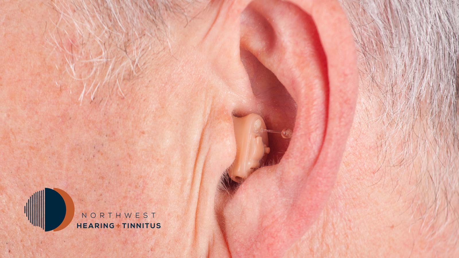 A Completely-In-The-Canal (CIC) Hearing Aid